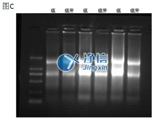 組織勻漿器對人結腸癌研磨效果